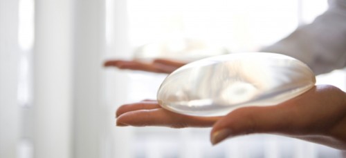 Spannend! Hoe gaat zo'n 3D-Consult bij Bergman Clinics eigenli...