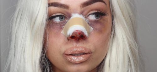 Volgens deze vlogger is plastische chirurgie nergens voor nodig